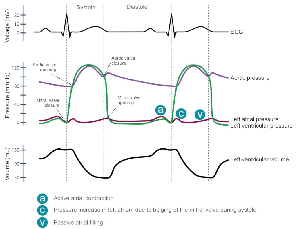Figure 6. A Wiggers diagram is a standard diagram used in cardiac physiology to illustrate the association between aortic pressure, ventricular pressure, atrial pressure, volumes and ECG waveforms.